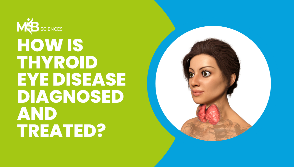 How Is Thyroid Eye Disease Diagnosed And Treated?